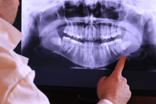 Best Urgent Dental Care in Kingston, RI