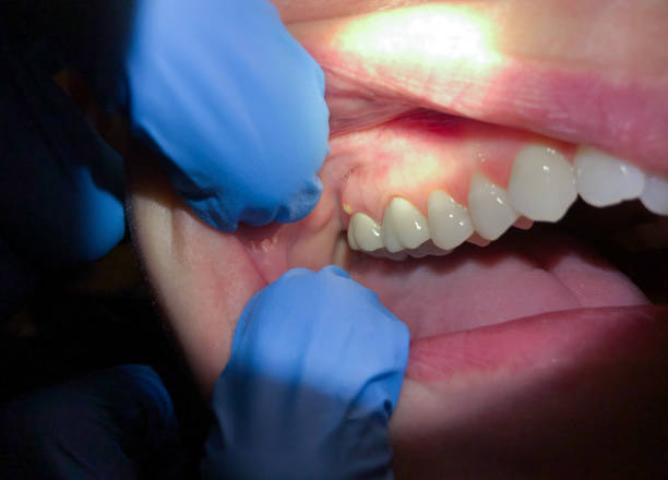 Best Emergency Dental Care for Trauma or Injury in Kingston, RI