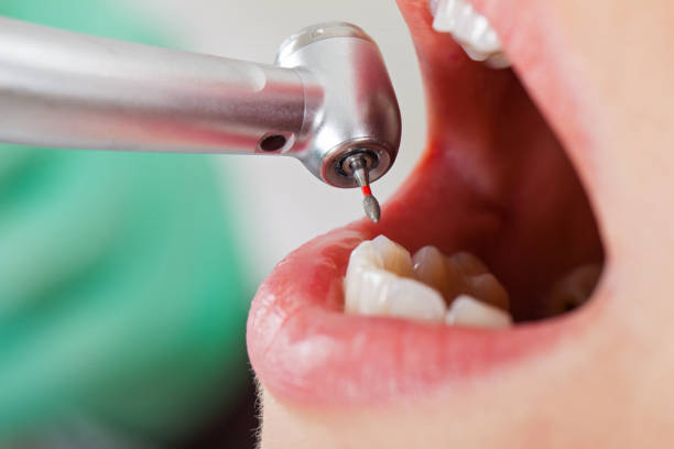 Best Weekend Emergency Dentist in Kingston, RI